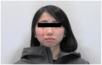 Reactivity of observers’ facial skin blood flow depending on others’ facial expressions and blushing